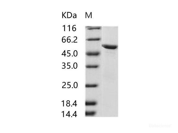 HIV-2 gp36 Recombinant Protein (subtype CRF01_AB, strain 07JP_NMC716_clone_01) (His & MBP Tag) (RPES6961)