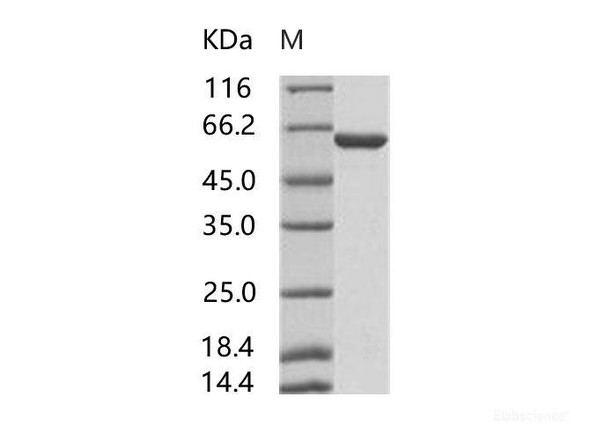 HIV-p51 / RT-p51 (group M, subtype B (isolate HXB2) Gag-Pol polyRecombinant Protein Recombinant Protein (His Tag) (RPES6962)
