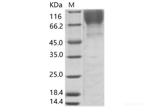 HIV-1 (group M, subtype B, Isolate MN) gp120 Recombinant Protein (His Tag) (RPES6974)