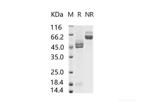 RSV (A2) Fusion glycoRecombinant Protein / RSV-F Recombinant Protein (His Tag) (RPES6981)