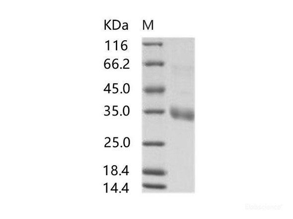 MERS-CoV Spike/RBD Recombinant Protein fragment (RBD, aa 367-606, His Tag) (RPES6987)