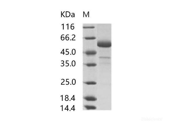 MERS-CoV Spike/RBD Recombinant Protein fragment (RBD, aa 367-606, rFc Tag) (RPES6989)