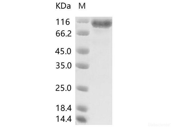 MERS-CoV Spike/S1 Recombinant Protein (S1 Subunit, aa 1-725, His Tag), HPLC-verified (RPES6992)