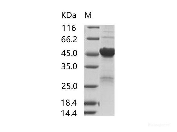 SARS-CoV NucleoRecombinant Protein / NP Recombinant Protein (His Tag) (RPES6998)