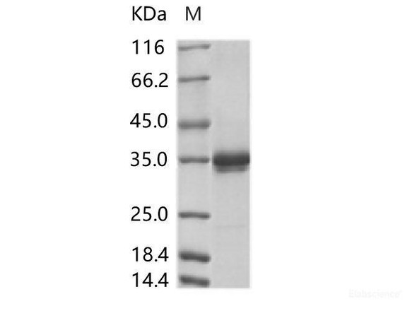 ZIKV (strain Zika SPH2016) Stem/anchor domain of flavivirus envelope glycoRecombinant Protein E Recombinant Protein (Fc Tag) (RPES7023)