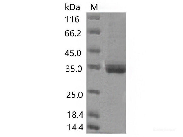 Recombinant SARS-CoV-2 Spike RBD (K417N) (His Tag) (RPES7090)