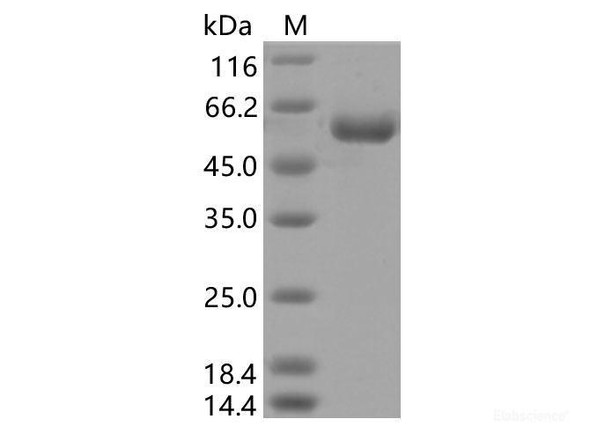 Recombinant SARS-CoV-2 Spike RBD (K417N) (rFc Tag) (RPES7098)