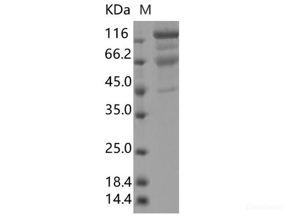 Recombinant SARS-CoV-2 Spike S1+S2 ECD (L18F, T20N, P26S, D138Y, R190S, K417T, E484K, N501Y, D614G, H655Y, T1027I) (His Tag ) (RPES7101)