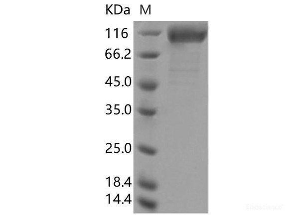 Recombinant SARS-CoV-2 Spike S1(Î”HV69-70, Y453F, D614G) (His Tag) (RPES7107)