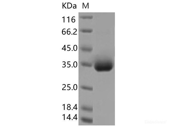 Recombinant SARS-CoV-2 Spike RBD (A522V) (His Tag) (RPES7141)