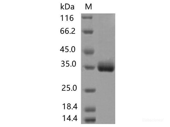 Recombinant SARS-CoV-2 Spike RBD (T393P) (His Tag) (RPES7169)
