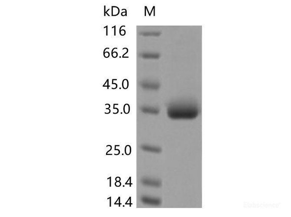 Recombinant SARS-CoV-2 Spike RBD (P479S) (His Tag) (RPES7178)