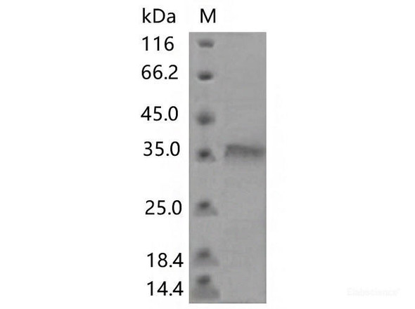 Recombinant SARS-CoV-2 Spike RBD (F456E) (His Tag) (RPES7188)