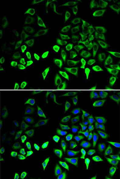 Anti-PKM Antibody (CAB0268)