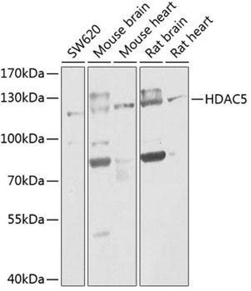 Anti-HDAC5 Antibody (CAB0632)