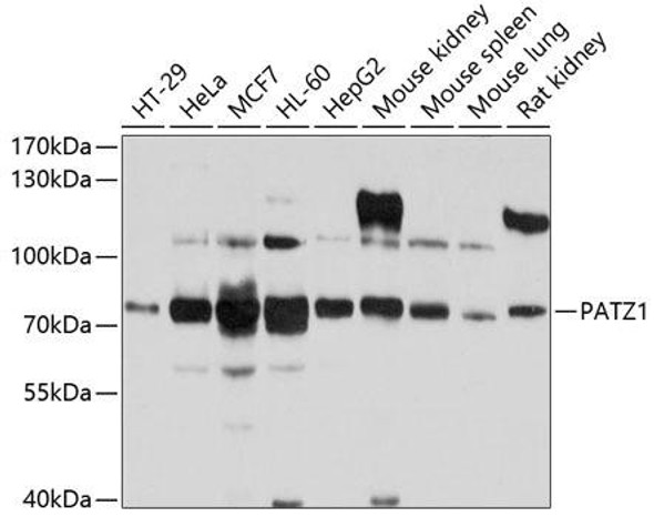 Anti-PATZ1 Antibody (CAB10053)