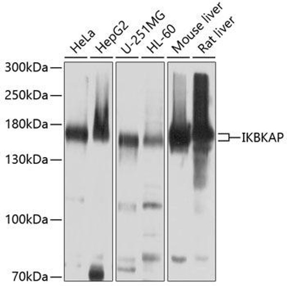 Anti-IKBKAP Antibody (CAB10127)