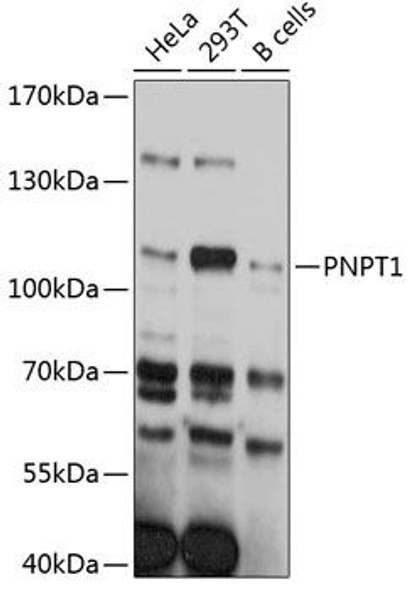 Anti-PNPT1 Antibody (CAB11676)