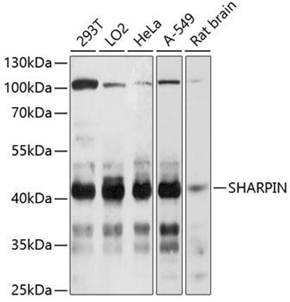 Anti-SHARPIN Antibody (CAB11714)