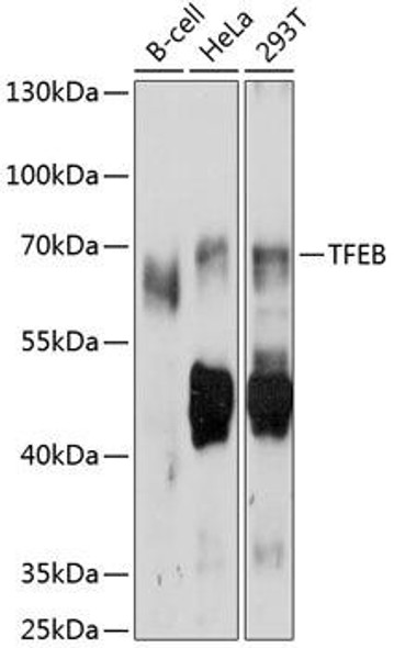 Anti-TFEB Antibody (CAB11796)