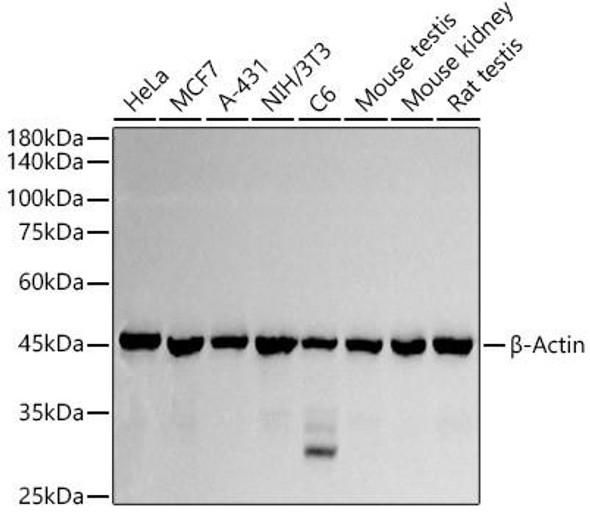 β-Actin Rabbit Polyclonal Antibody (CABC006)