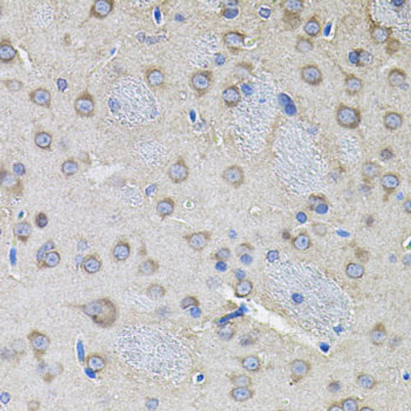 Anti-IKKGamma Antibody (CAB12561)