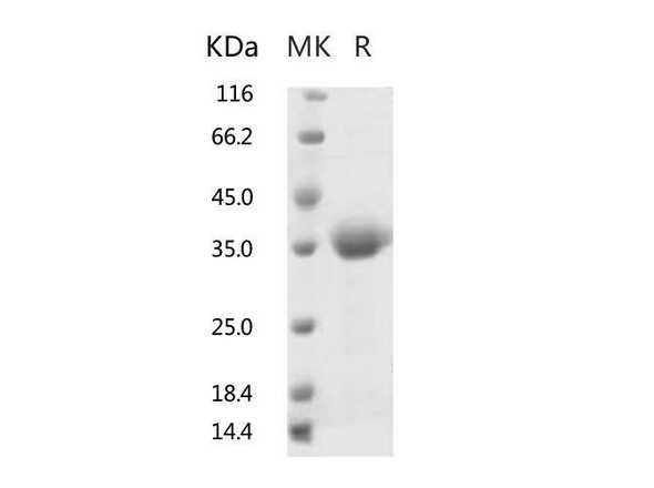 2019-nCoV Spike Recombinant Protein (RBD) (RPES0066)