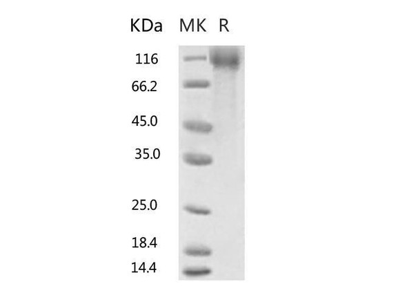 2019-nCoV S1 Recombinant Protein (RPES0060)