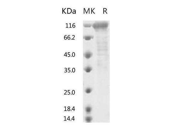 2019-nCoV S2 Recombinant Protein (RPES0062)