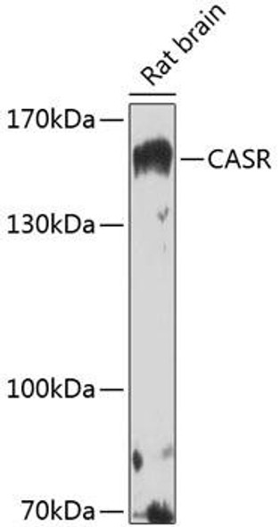 Anti-CASR Antibody (CAB13000)