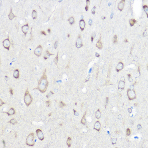 Anti-SARS Antibody (CAB13350)