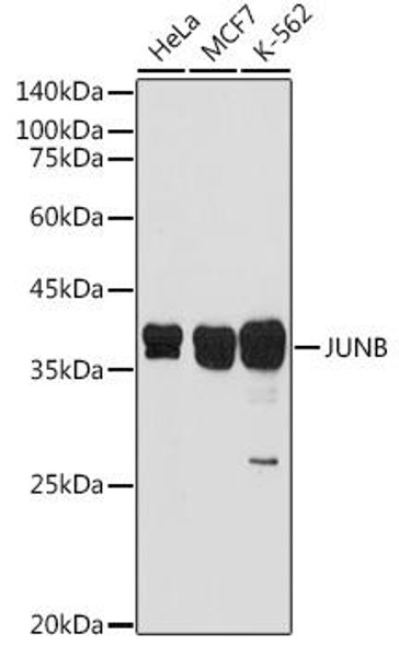 Anti-JUNB Antibody (CAB14566)