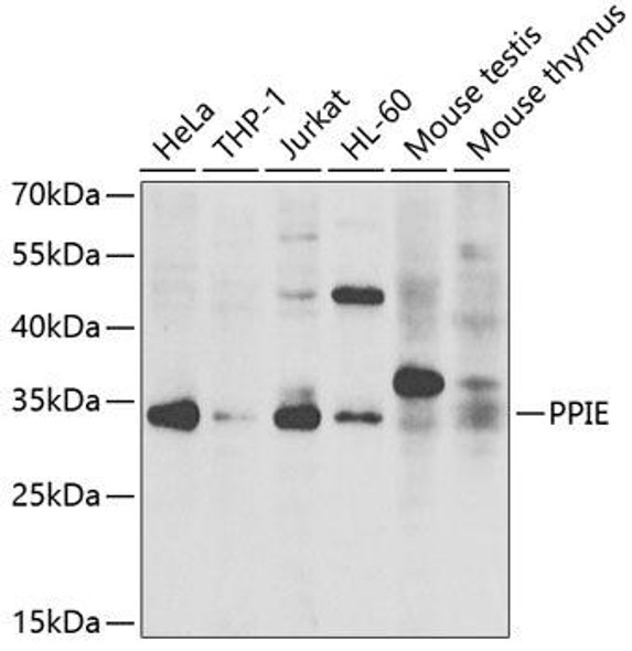 Anti-PPIE Antibody (CAB7061)