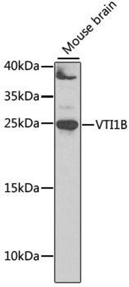 Anti-VTI1B Antibody (CAB7062)