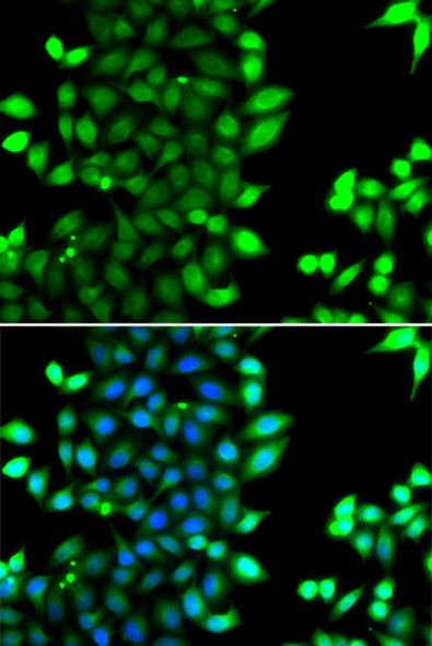 Anti-RNF7 Antibody (CAB7301)