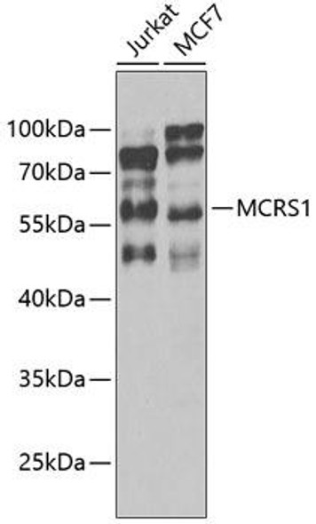 Anti-MCRS1 Antibody (CAB8061)