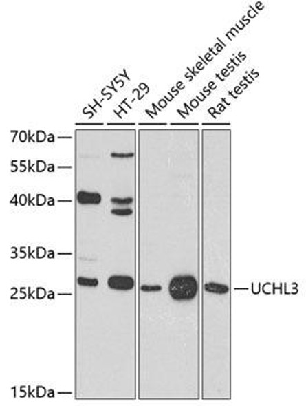 Anti-UCHL3 Antibody (CAB8156)