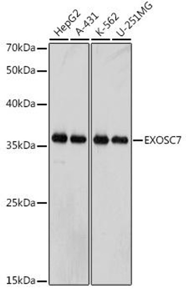 Anti-EXOSC7 Antibody (CAB0341)