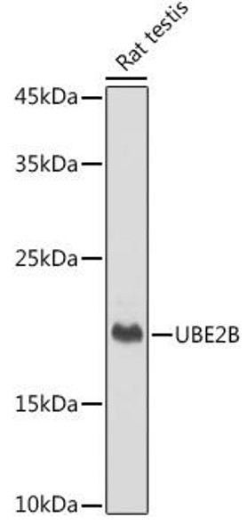 Anti-UBE2B Antibody (CAB0503)