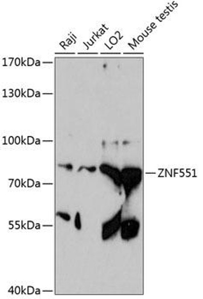 Anti-ZNF551 Antibody (CAB13780)