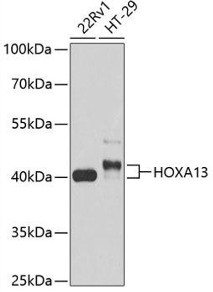 Anti-HOXA13 Antibody (CAB13999)