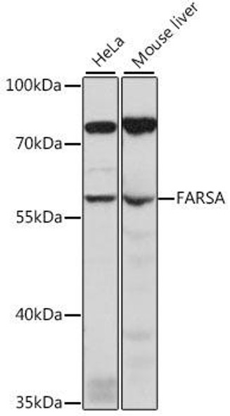 Anti-FARSA Antibody (CAB15670)
