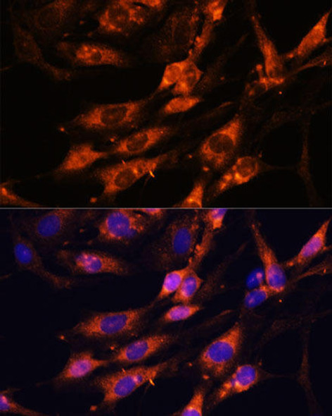 Anti-TENM1 Antibody (CAB15774)