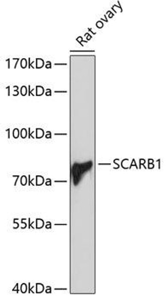 Anti-SCARB1 Antibody (CAB1584)