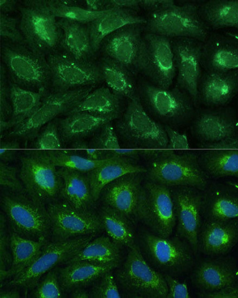 Anti-ABCD2 Antibody (CAB16033)