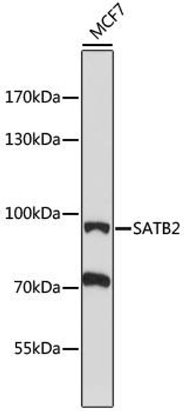 Anti-SATB2 Antibody (CAB16721)