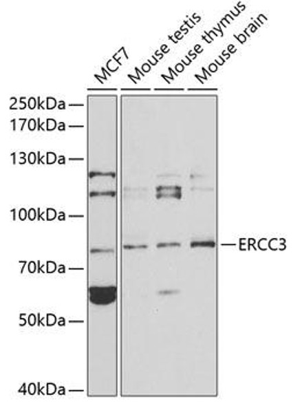 Anti-ERCC3 Antibody (CAB1714)