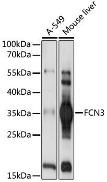 Anti-FCN3 Antibody (CAB17352)