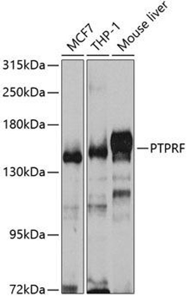 Anti-PTPRF Antibody (CAB5444)