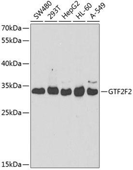 Anti-GTF2F2 Antibody (CAB5826)